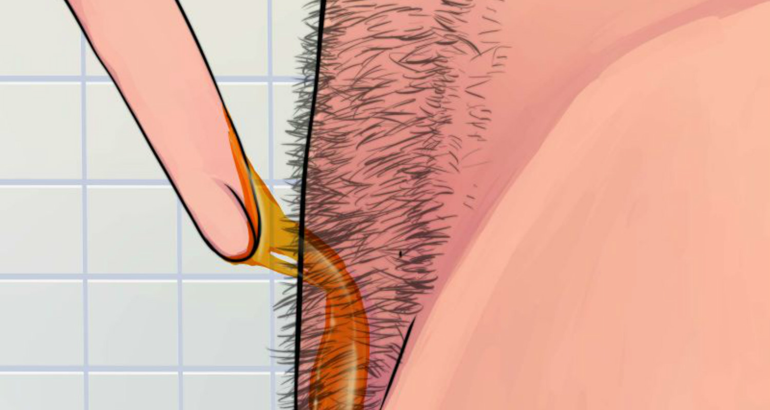 History of shaved pubic hair