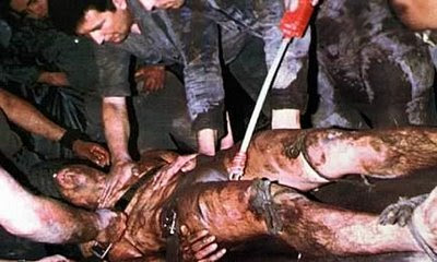 catheter torture