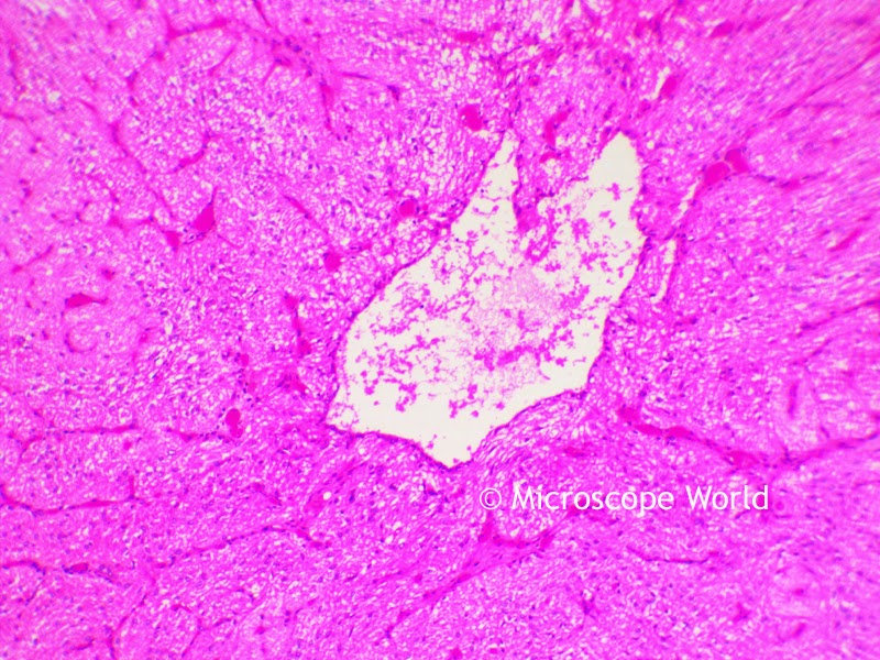 Gland under the microscope at 100x.
