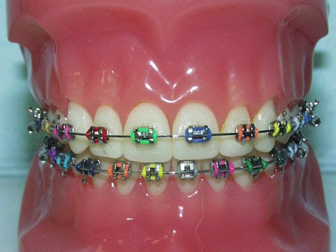 Traitement orthodontique Estimation des coûts