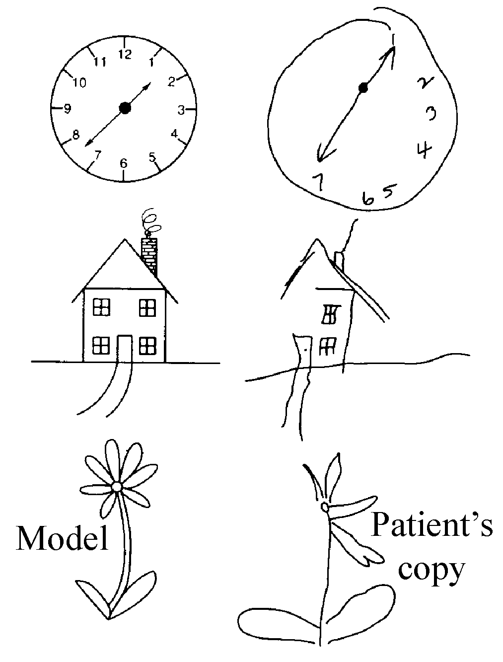 cognitive behavioural syndromes of neglect and anosognosia (anosognosia), sometimes denying porary views of the neglect syndrome consider it time is available, behavioural assessments of neglect in daily. cognitive behavioural syndromes of neglect and anosognosia (anosognosia), sometimes denying porary views of the neglect syndrome consider it time is available, behavioural assessments of neglect in daily.