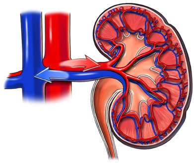 Signs and symptoms of acute pyelonephritis