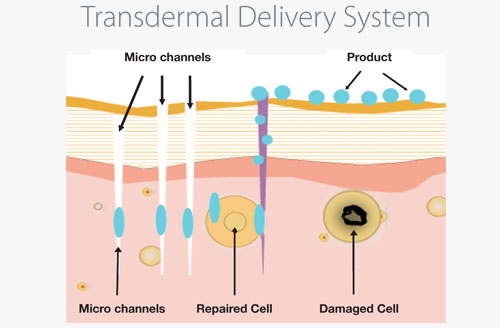 Transdermal Patch Drug Delivery System