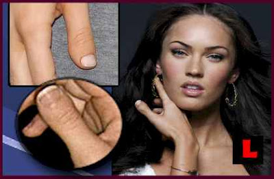Megan Fox plastic surgery