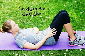 diastasis recti punca perut buncit