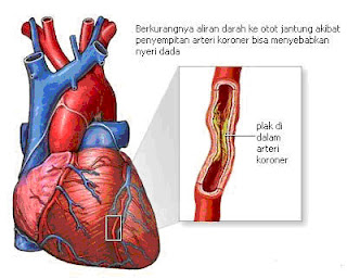 Makanan Sehat Untuk Jantung