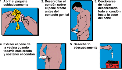 Hay cuanto una operación de la corrección del miembro