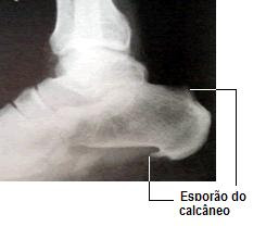 Exercícios de aumento em um pênis masculino
