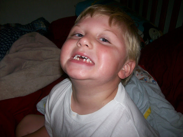Toothless Brady