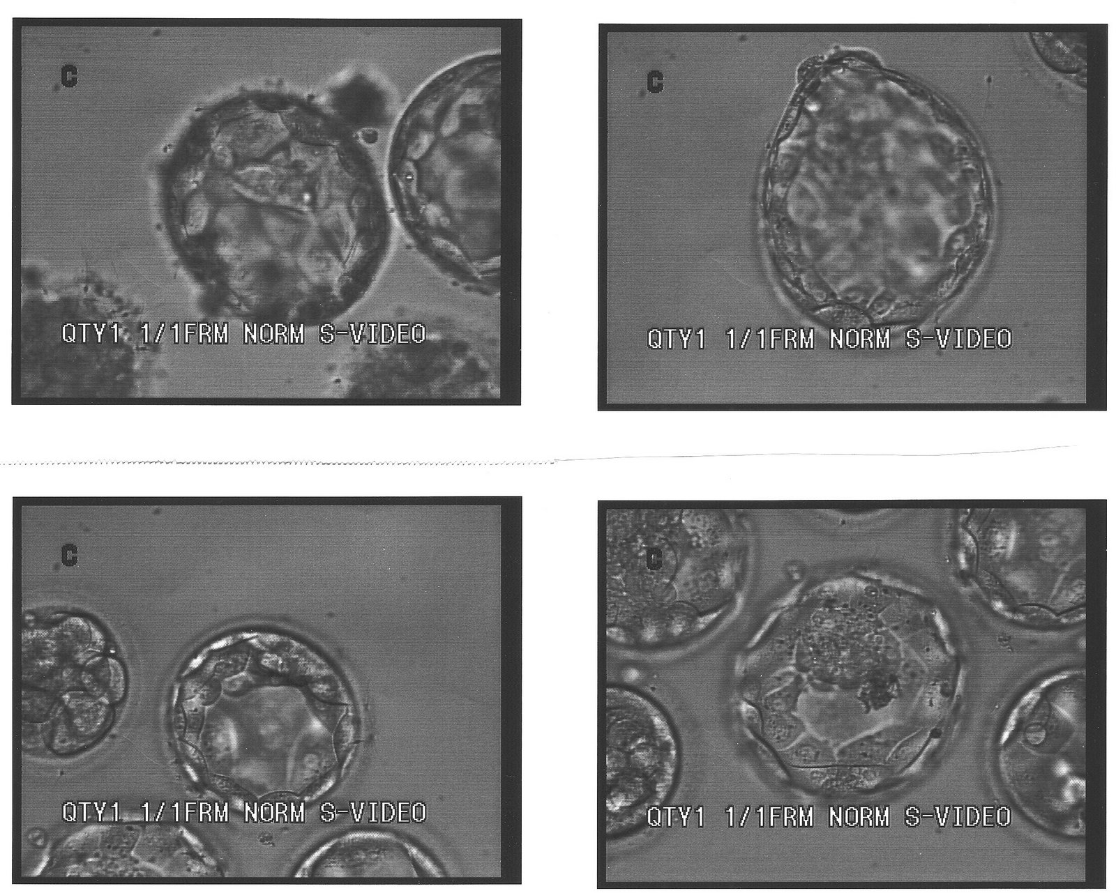 [Fertilized+Embryos+that+were+put+in+on+2-1-07.jpg]