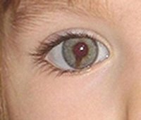 [LP+ojo.jpg]