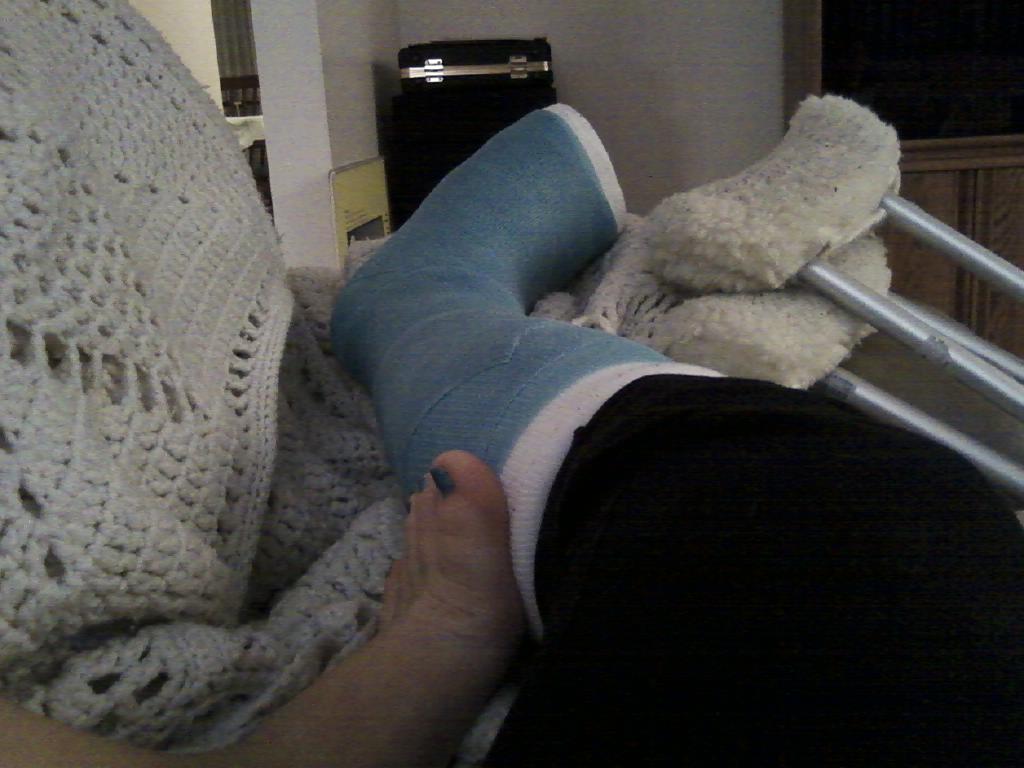 My Daily Adventures with Me and My Broken Leg Bye Bye Candy Cane Cast!