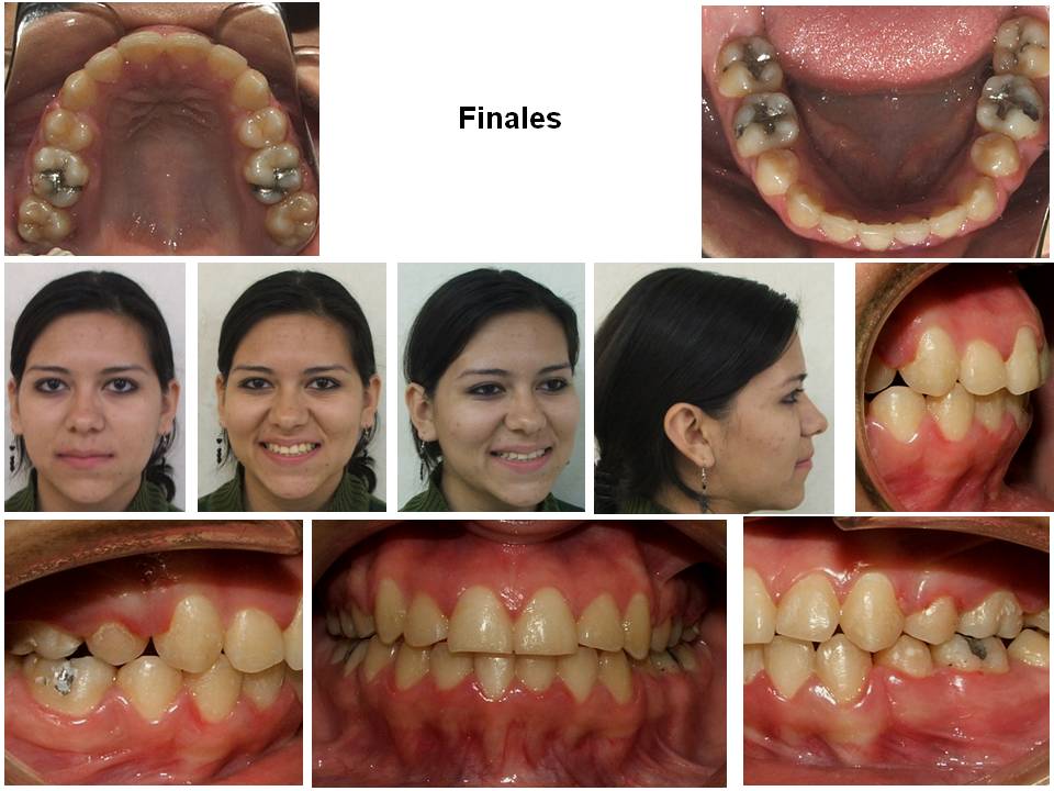 Orthodontist in Nuevo Progreso Brackets ¿QUE ES LA ORTODONCIA?