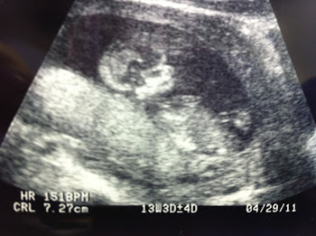 Our Baby 13 Weeks