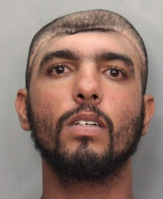 Man With Half A Head