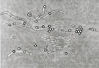 Les parasites dans le hareng salé vidéo