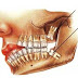 Mito: O dente Siso nasceu de empurrou ou destruiu meus dentes