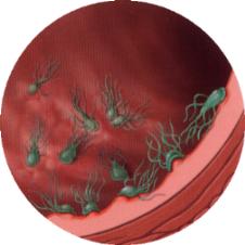 Giardia Worm