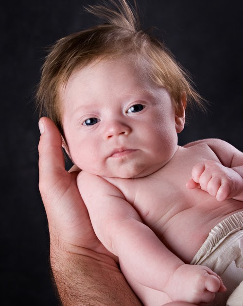 The Baby Who Chose Us Pectus Excavatum??
