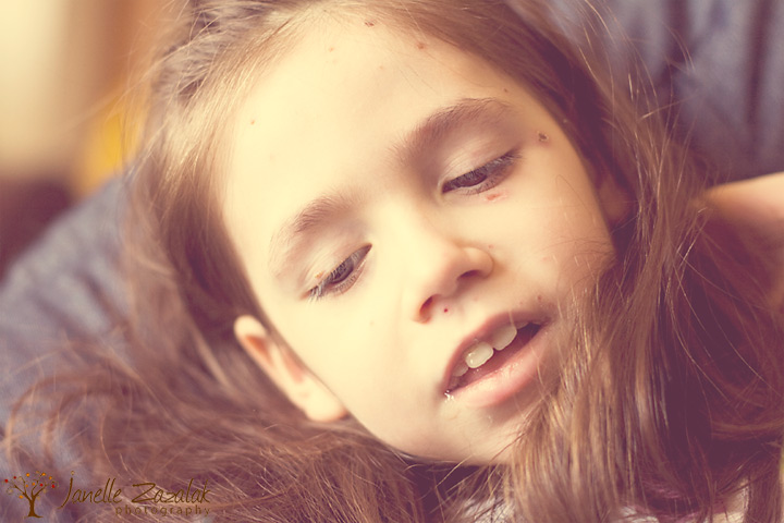 chicken pops pictures