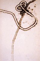 el virus visto en el microscopio