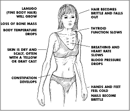 Watch Bulimia Nervosa (Eating Disorder) – Symptoms, Causes, And Treatments video Watch Bulimia Nervosa (Eating Disorder) – Symptoms, Causes, And Treatments video