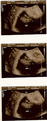 My grandbaby