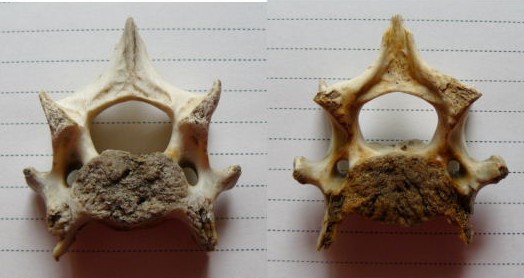 [上面下面第三頚椎.jpg]