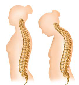 CENTRO COLUMNA VERTEBRAL S C centro columna vertebral s c: