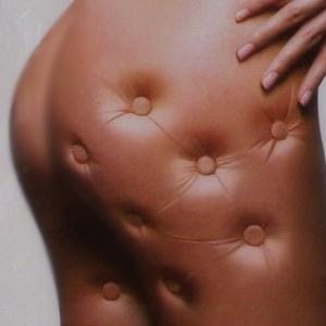 celulitis