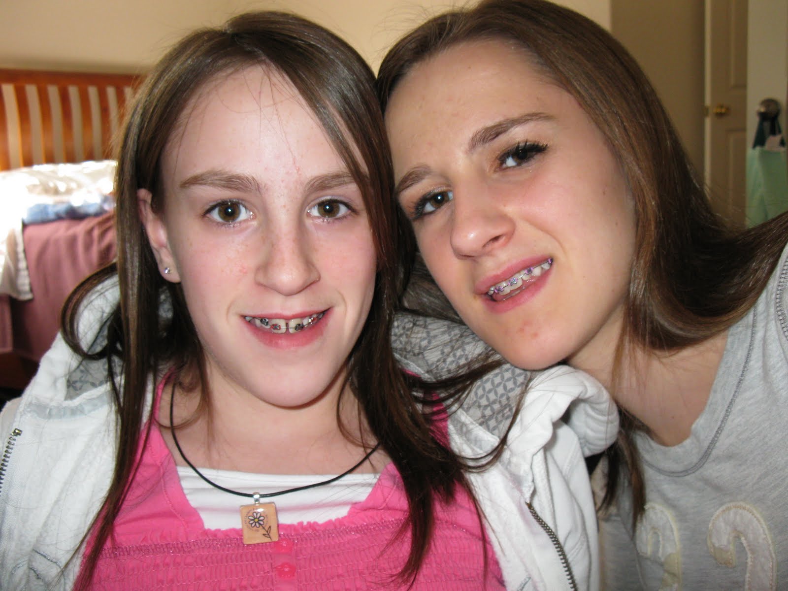 The Murdoch Family Braces!!