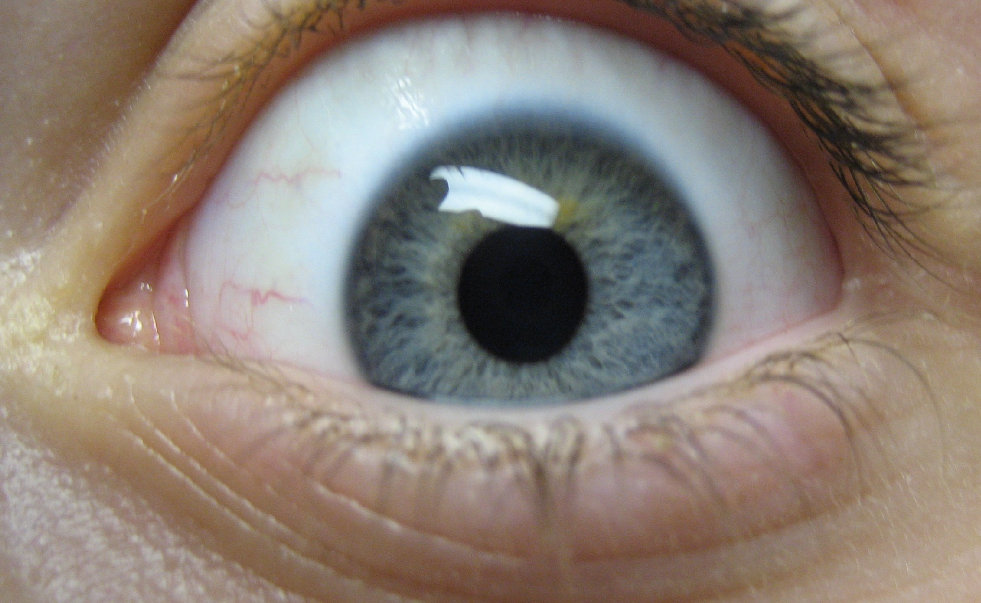 eye ball ache eye ball ache
