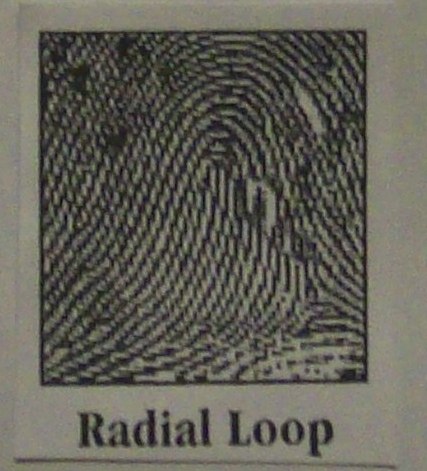 [radial+loop.jpg]