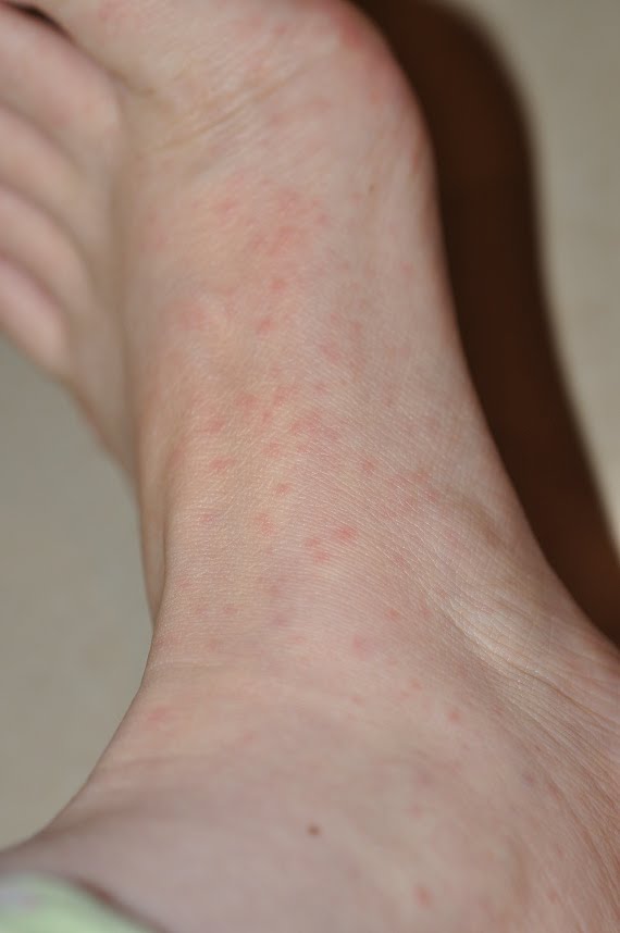 Sparrow(gal)'s Fart OMG Holy Hand foot and Mouth! My