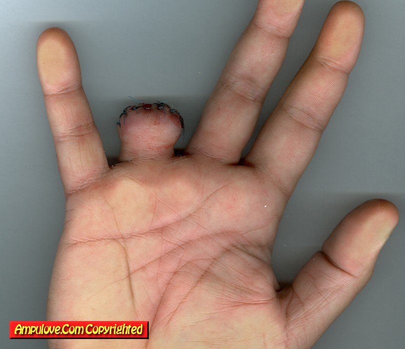 [ringfinger_day3_03.jpg]