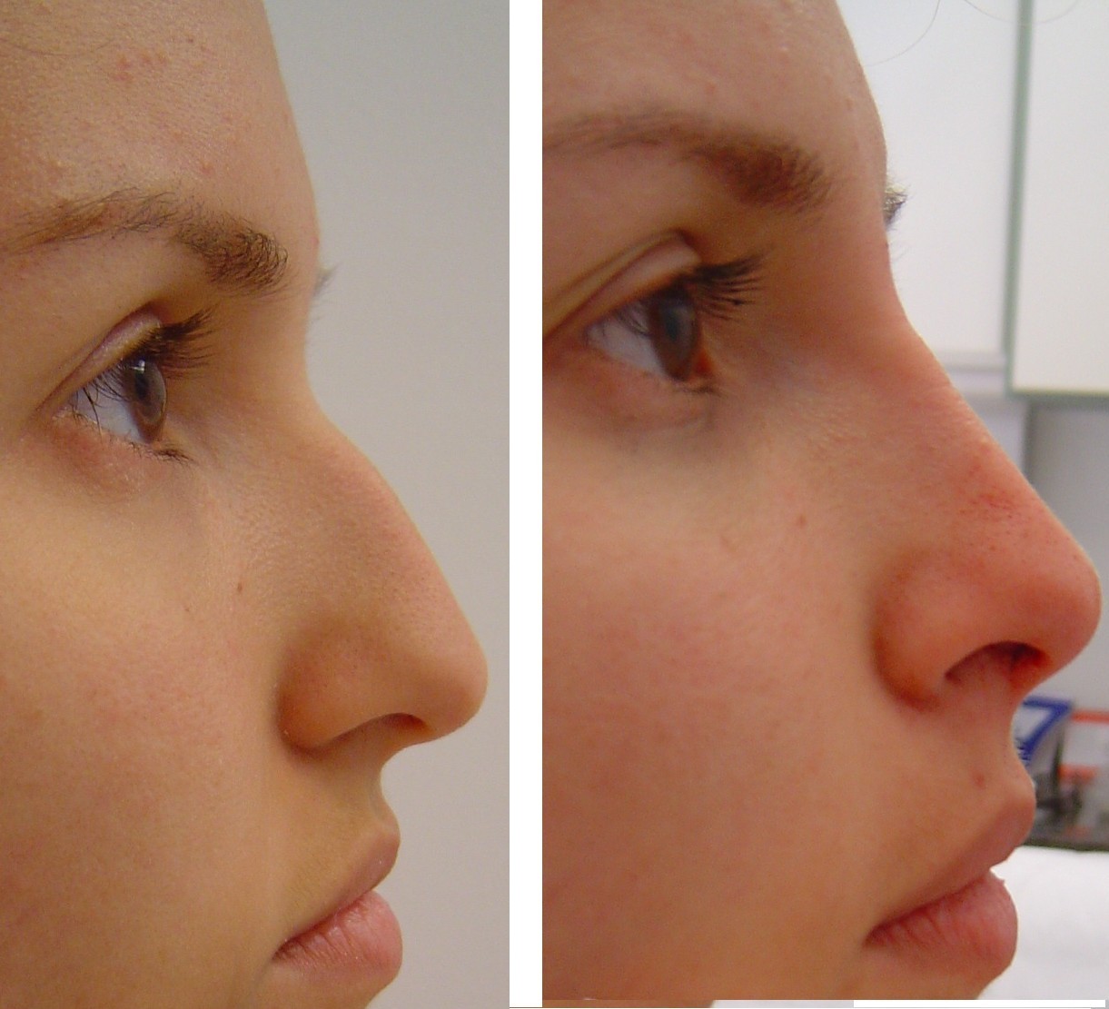 [nariz+da+tita+editado+p+site.jpg]