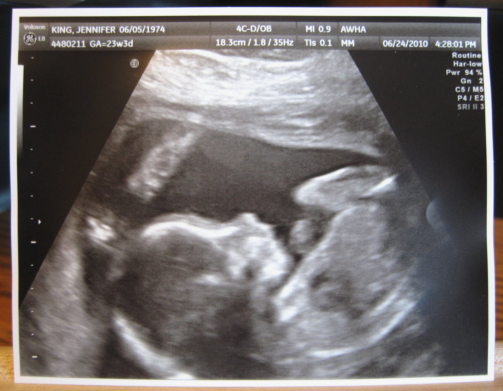 Lookie What I Can Do!! 23 week ultrasound in 3D!
