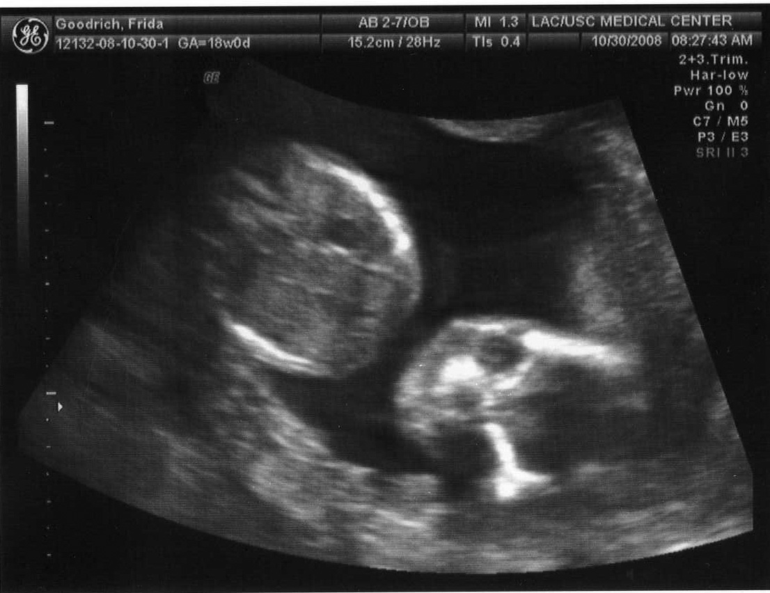 [baby4.jpg]
