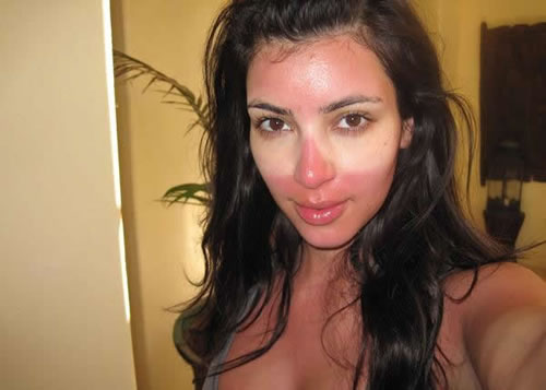 How To Get Back Your Natural Skin Color After Sunburn How To Get Back Your Natural Skin Color After Sunburn