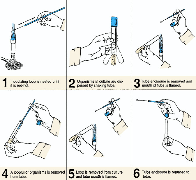 Avibert Procedure for removing organisms from a broth culture with