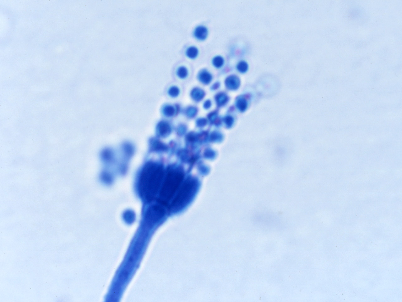 Is aspergillus single or multicellular