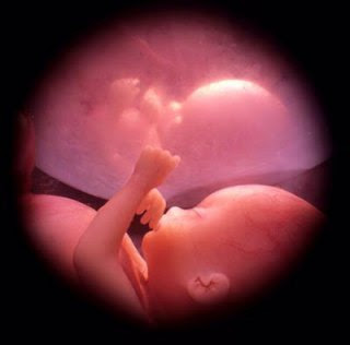 Montini-P6, le fils du MAL - Page 2 Aborto+-+Eugenesia
