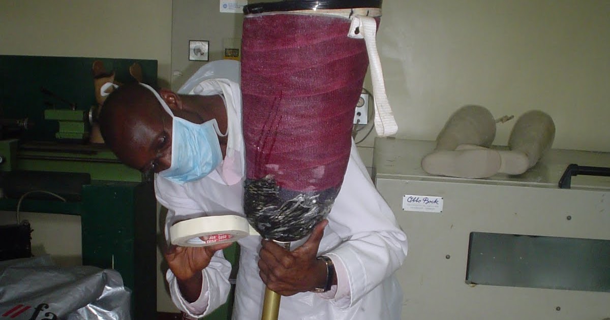 Immediate post operative prosthesis picture