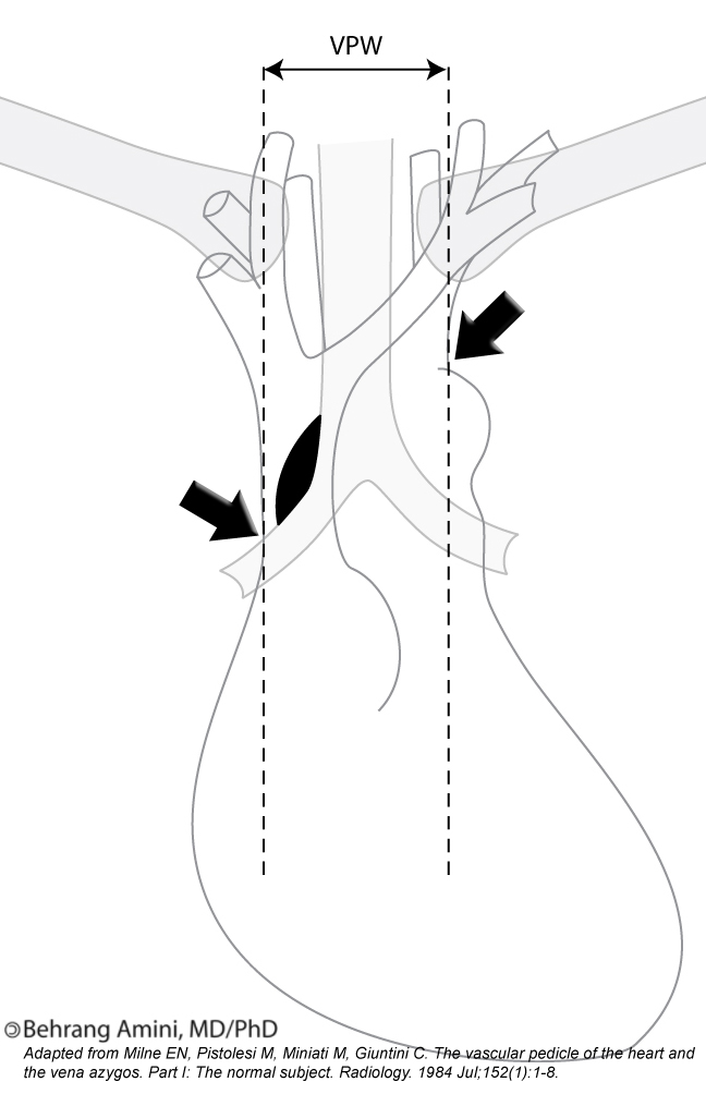 Roentgen Ray Reader The Vascular Pedicle