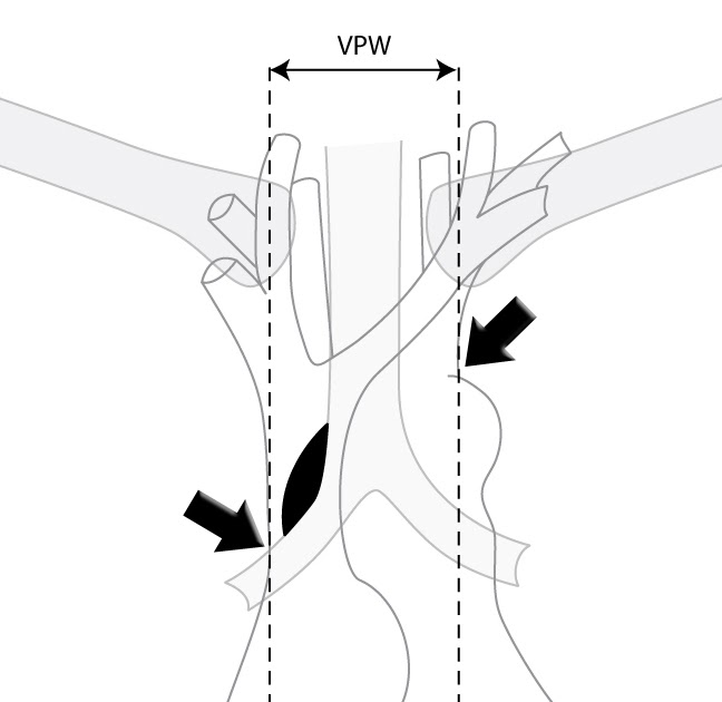 Roentgen Ray Reader The Vascular Pedicle