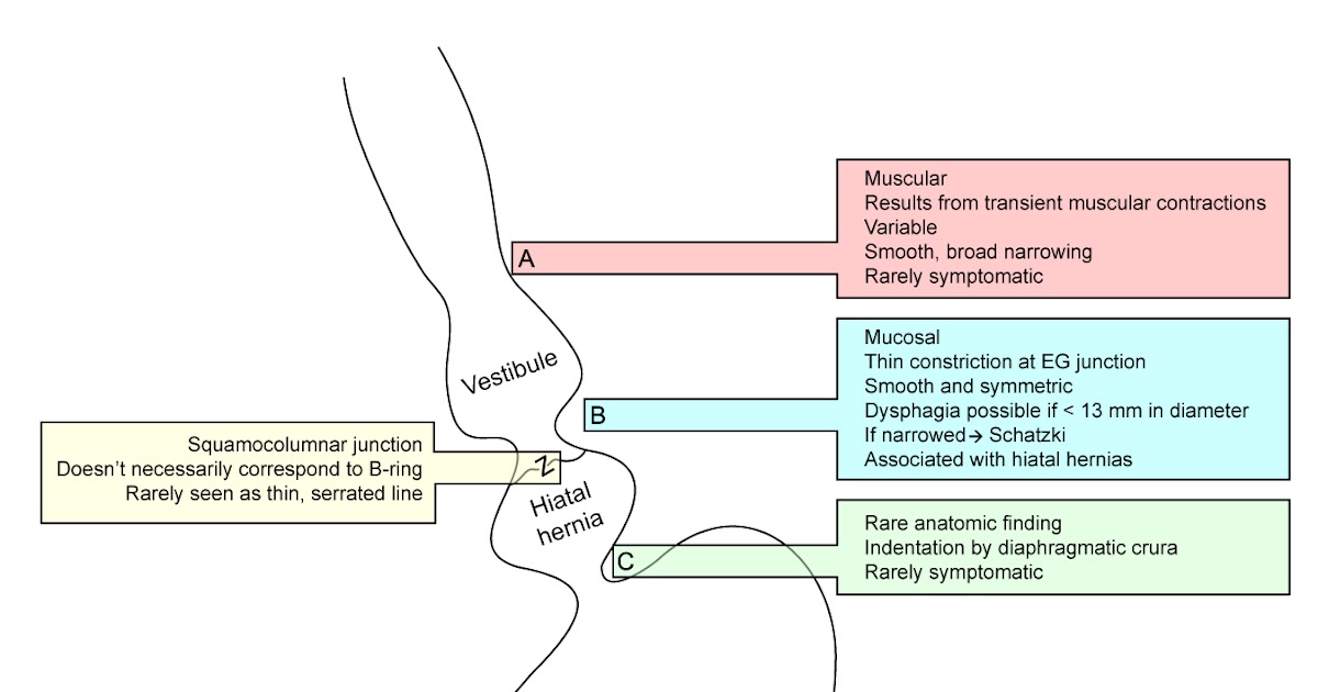 Roentgen Ray Reader Esophageal Rings