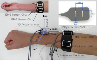 Applications of emg in medical diagnosis picture