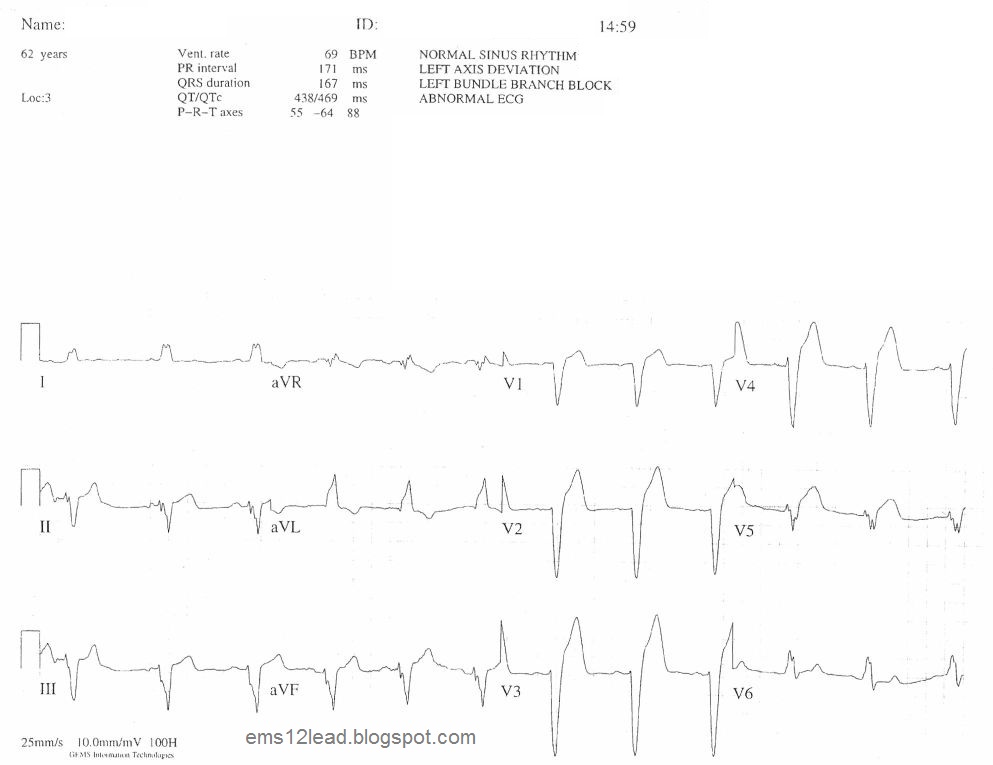 avrage bp for a 62 year old man