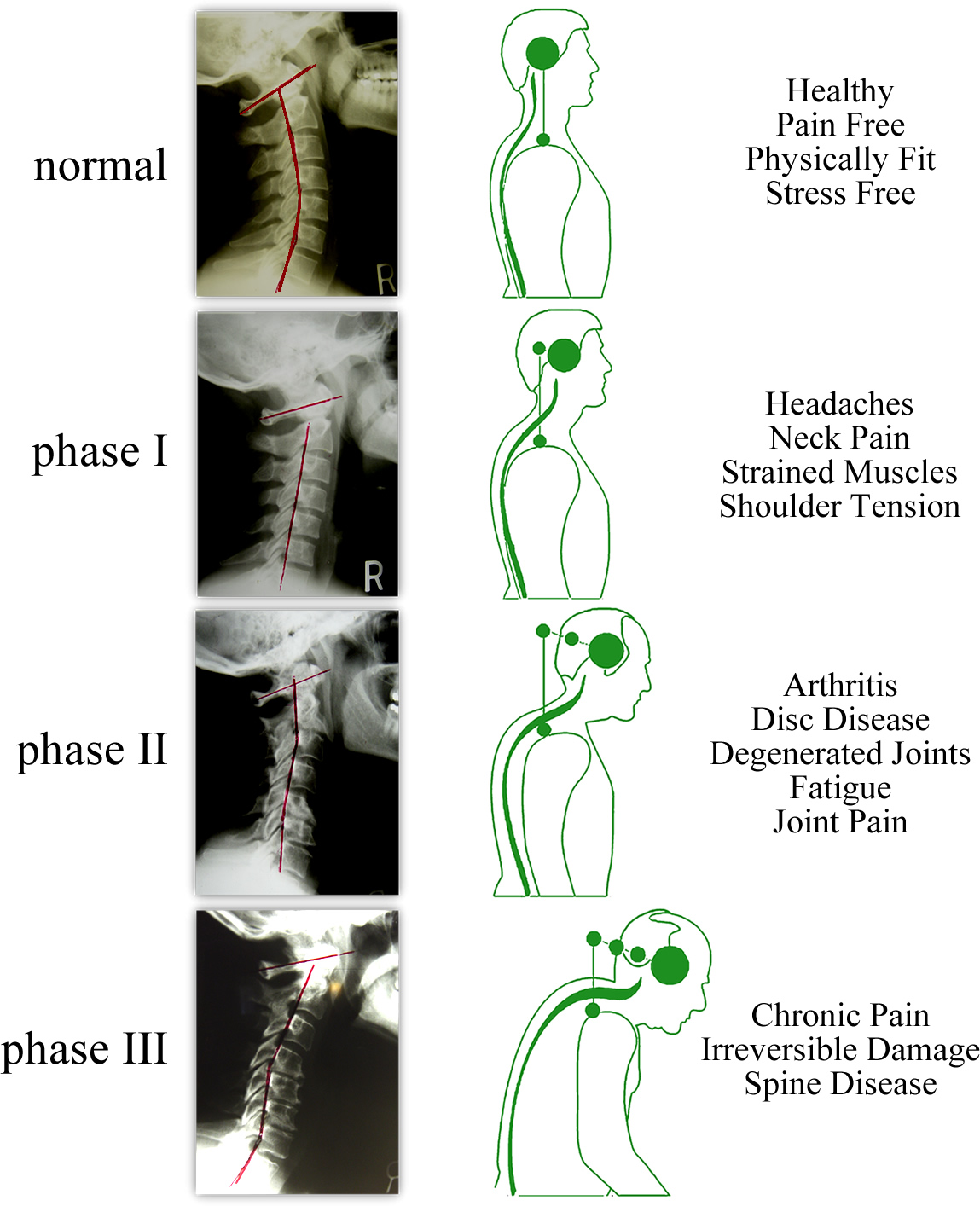 DFW Wellness Fundamentals Posture is the Window to Your Spine...