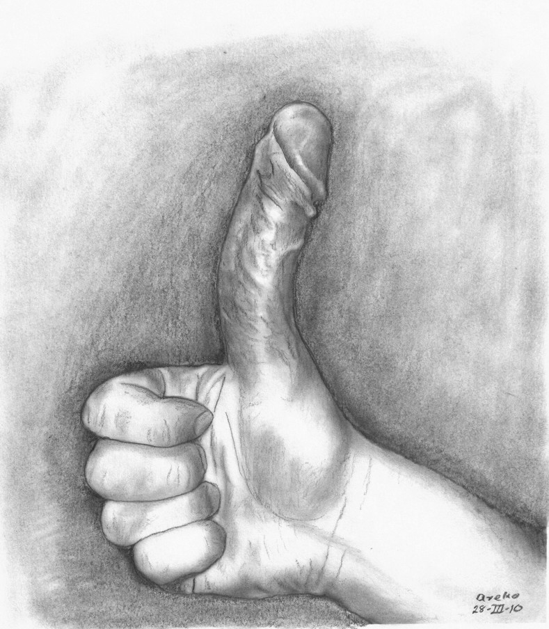 diabetes and sex for men penis drawing